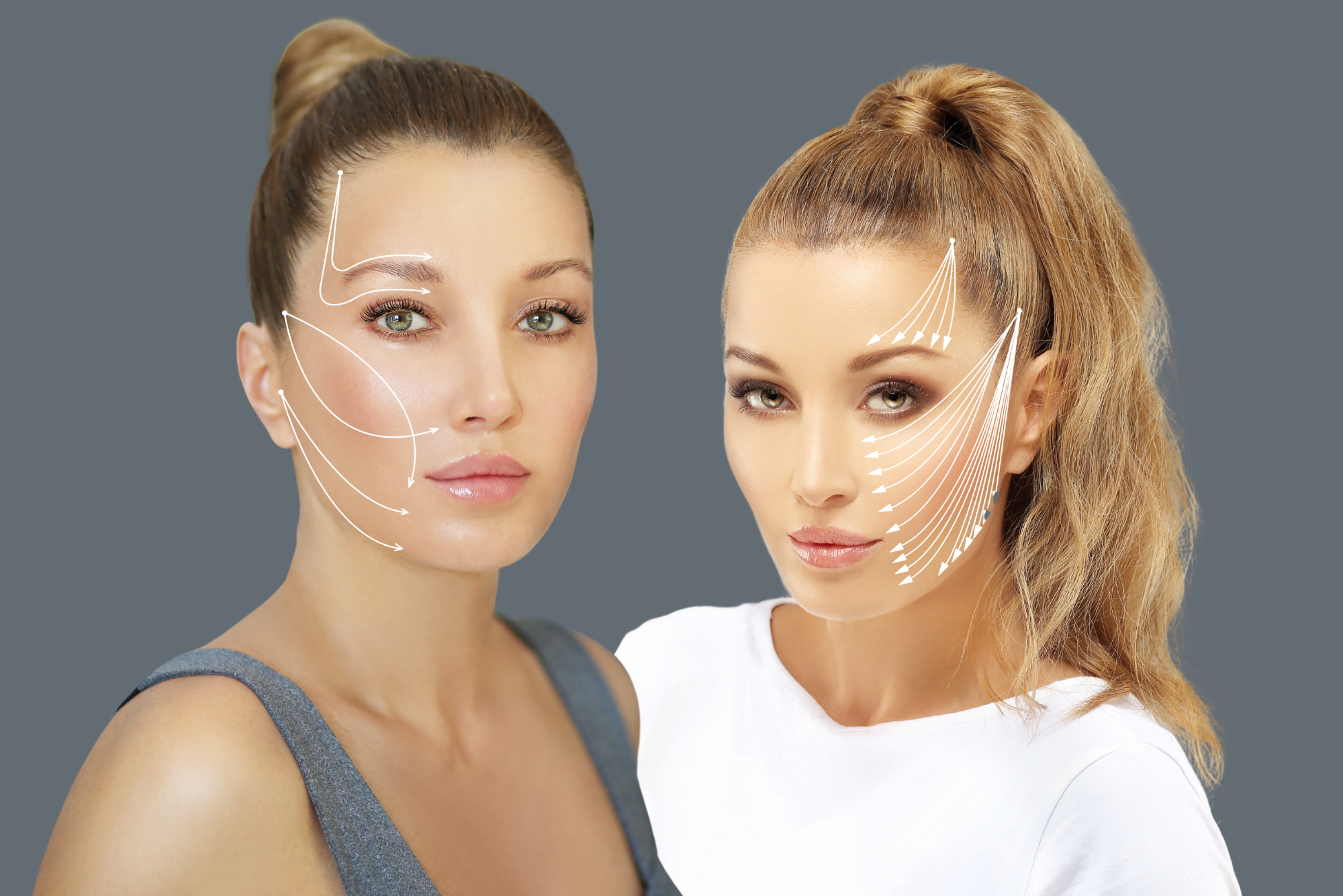 Two women with marks on face for thread lift